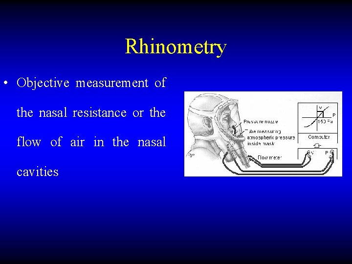 Rhinometry • Objective measurement of the nasal resistance or the flow of air in