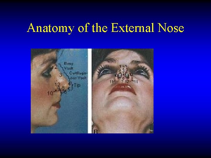 Anatomy of the External Nose 