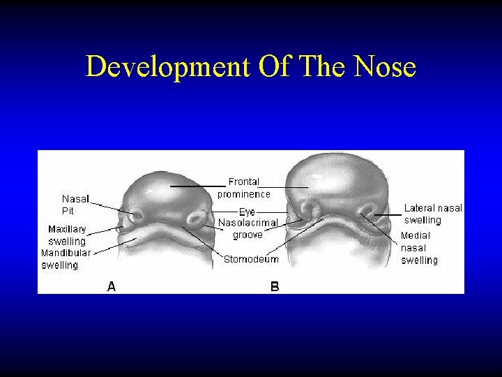 Development Of The Nose 