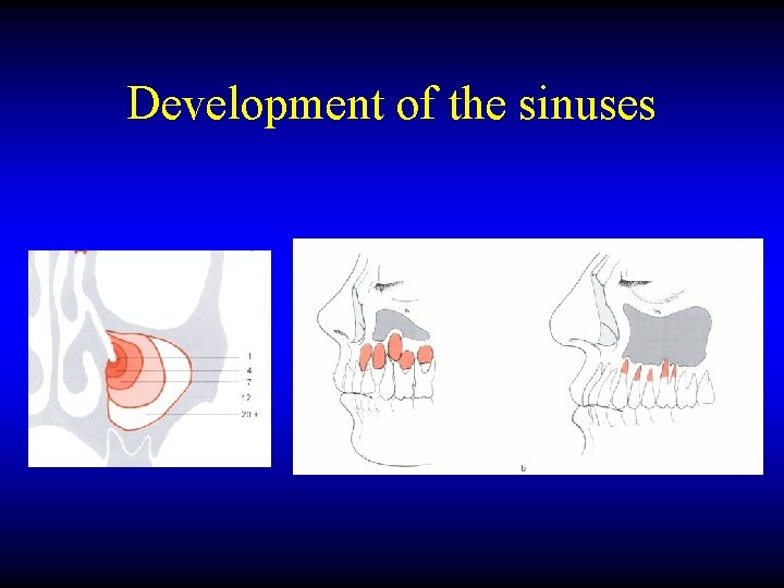 Development of the sinuses 