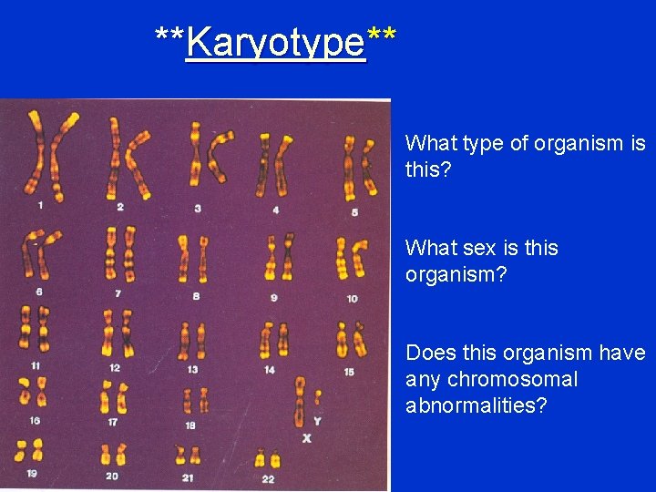 **Karyotype** What type of organism is this? What sex is this organism? Does this