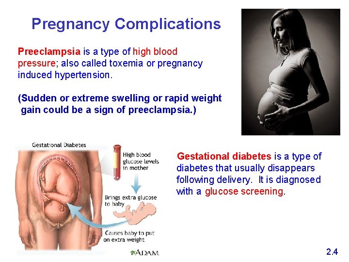 Pregnancy Complications Preeclampsia is a type of high blood pressure; also called toxemia or