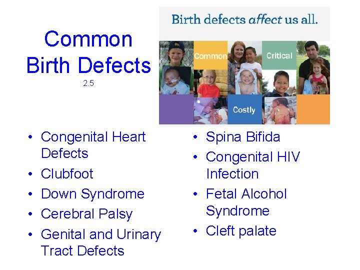 Common Birth Defects 2. 5 • Congenital Heart Defects • Clubfoot • Down Syndrome