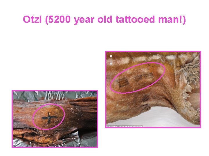 Otzi (5200 year old tattooed man!) 