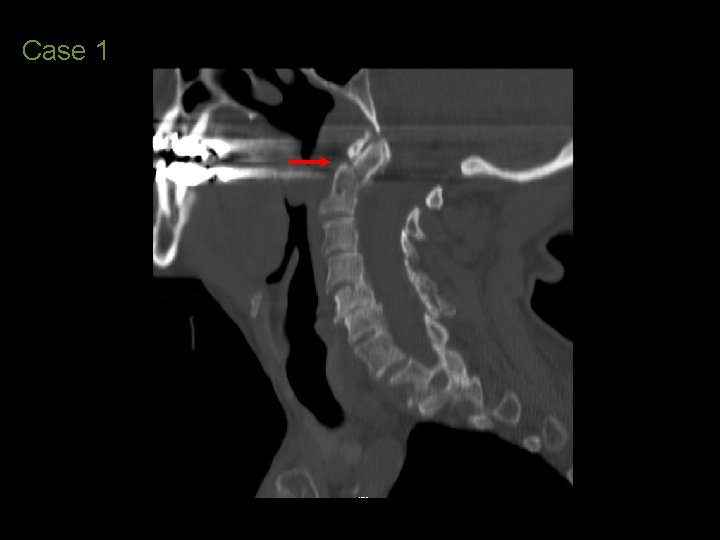Case 1 