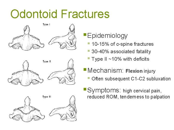Odontoid Fractures § Epidemiology § 10 -15% of c-spine fractures § 30 -40% associated
