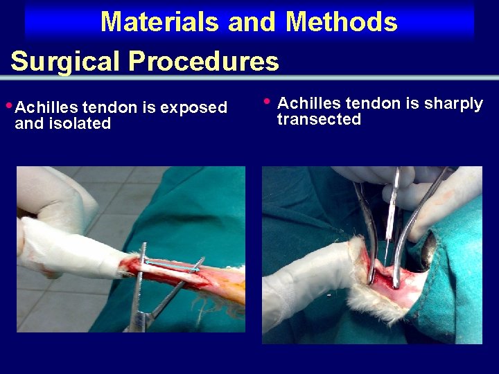 Materials and Methods Surgical Procedures • Achilles tendon is exposed and isolated • Achilles