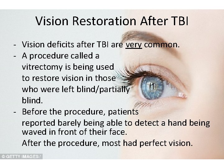 Vision Restoration After TBI - Vision deficits after TBI are very common. - A