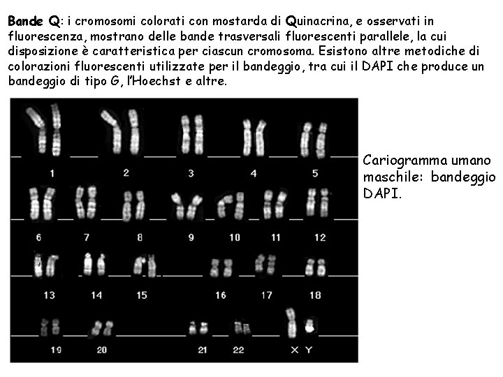 Bande Q: i cromosomi colorati con mostarda di Quinacrina, e osservati in fluorescenza, mostrano