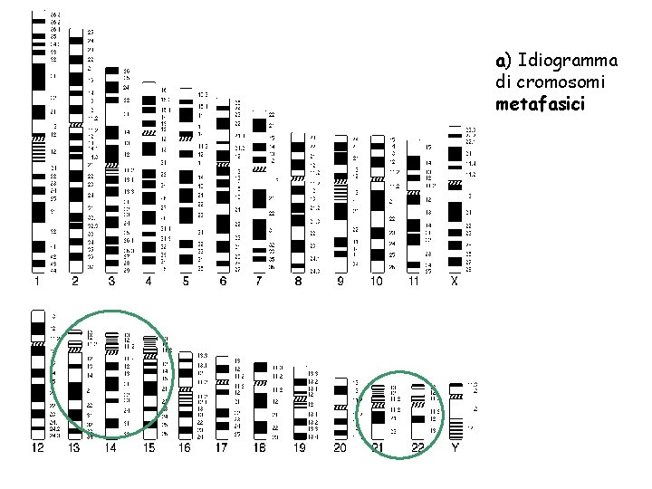 a) Idiogramma di cromosomi metafasici 