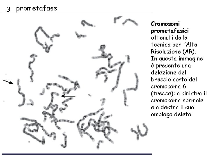 3 prometafase Cromosomi prometafasici ottenuti dalla tecnica per l’Alta Risoluzione (AR). In questa immagine