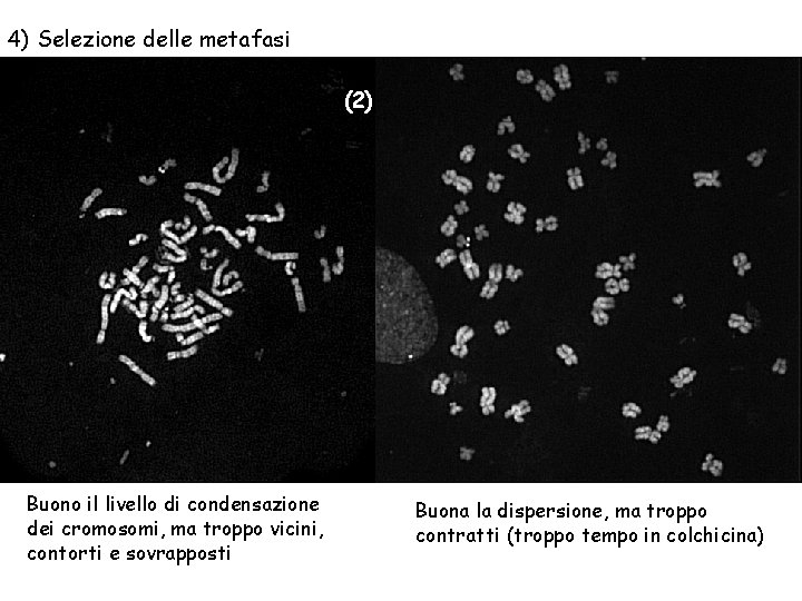 4) Selezione delle metafasi (2) Buono il livello di condensazione dei cromosomi, ma troppo