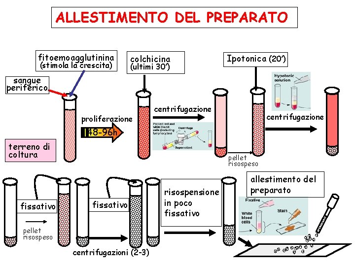 ALLESTIMENTO DEL PREPARATO fitoemoagglutinina (stimola la crescita) colchicina (ultimi 30’) Ipotonica (20’) sangue periferico