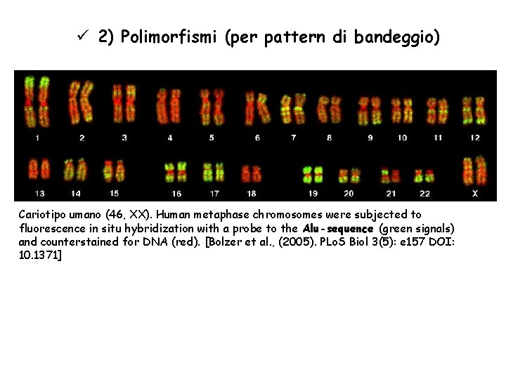 ü 2) Polimorfismi (per pattern di bandeggio) Cariotipo umano (46, XX). Human metaphase chromosomes