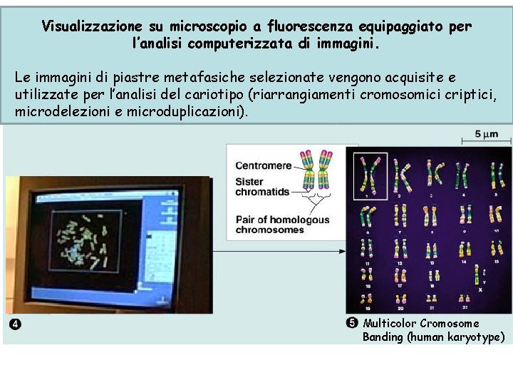 Visualizzazione su microscopio a fluorescenza equipaggiato per l’analisi computerizzata di immagini. Le immagini di