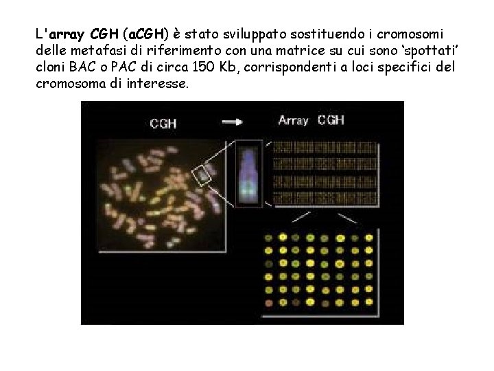 L'array CGH (a. CGH) è stato sviluppato sostituendo i cromosomi delle metafasi di riferimento