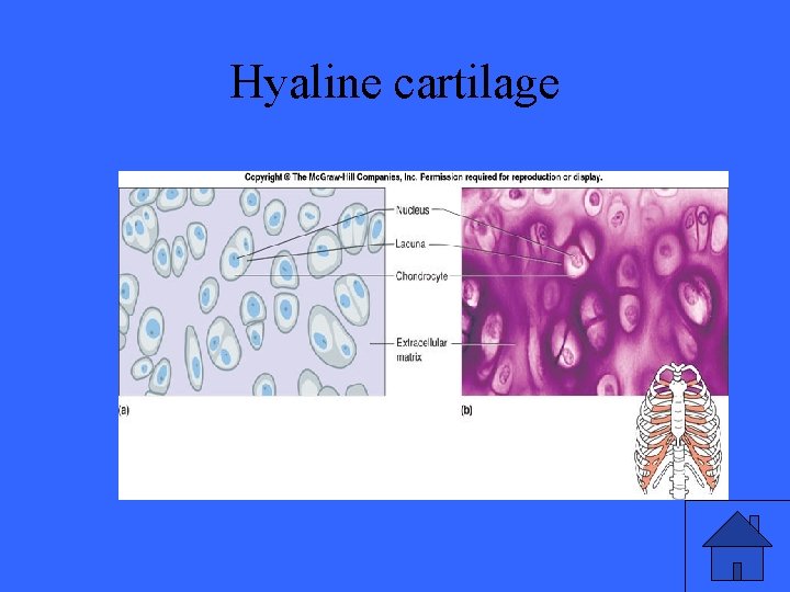 Hyaline cartilage 