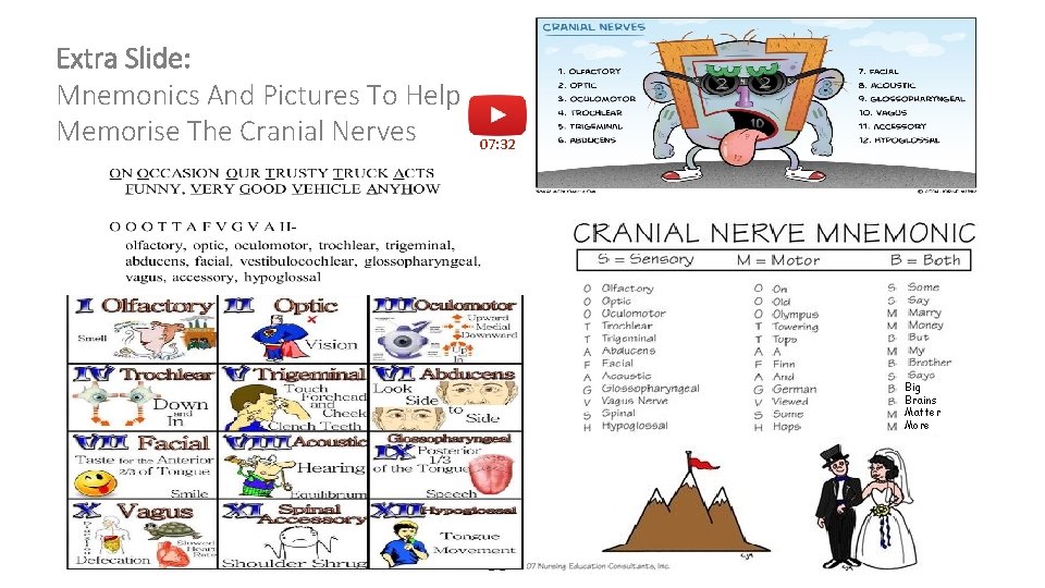 Extra Slide: Mnemonics And Pictures To Help Memorise The Cranial Nerves 07: 32 Big