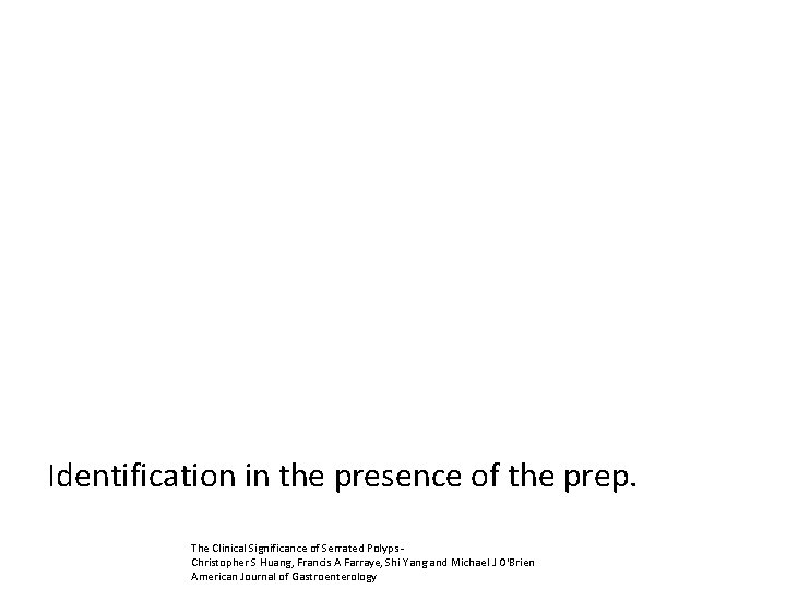 Identification in the presence of the prep. The Clinical Significance of Serrated Polyps Christopher