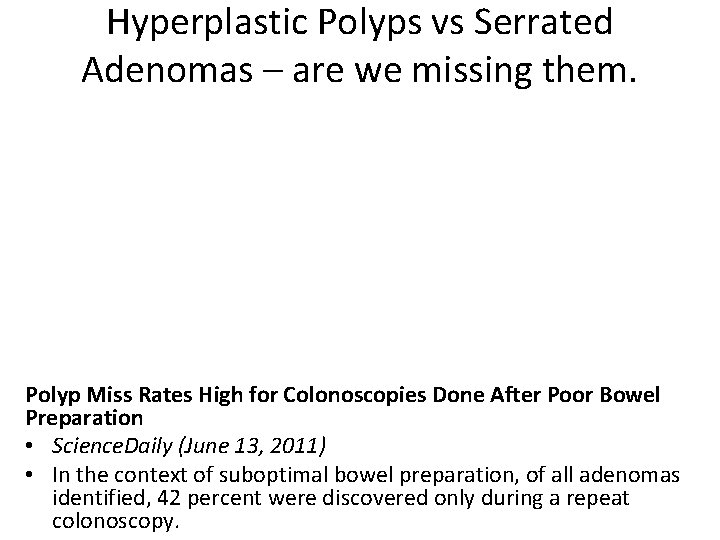 Hyperplastic Polyps vs Serrated Adenomas – are we missing them. Polyp Miss Rates High