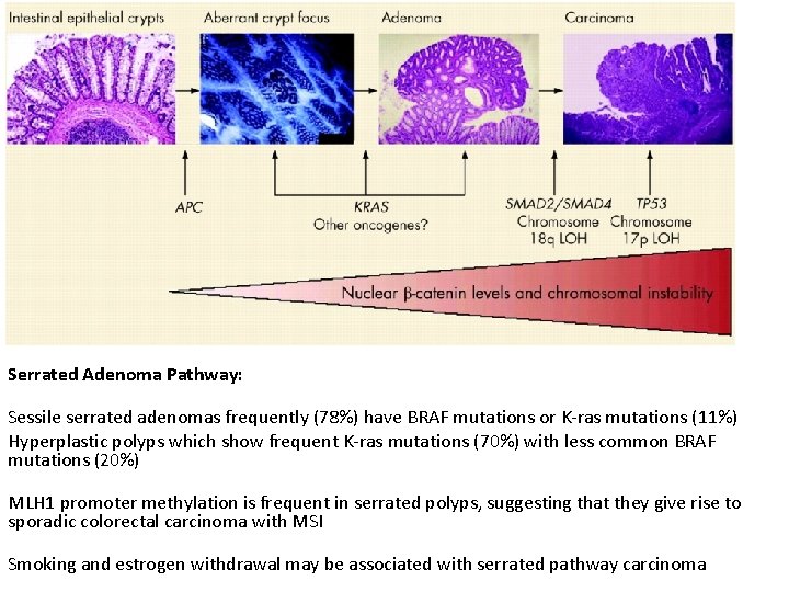 Serrated Adenoma Pathway: Sessile serrated adenomas frequently (78%) have BRAF mutations or K-ras mutations