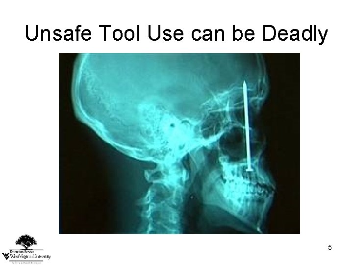 Unsafe Tool Use can be Deadly 5 