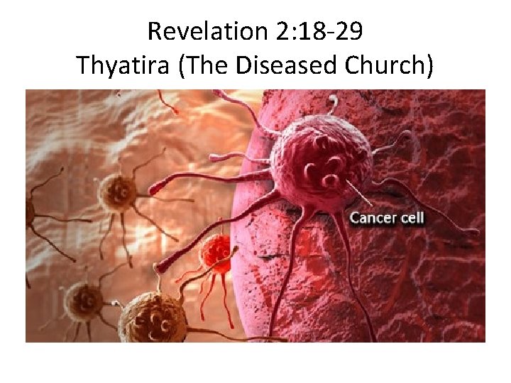 Revelation 2: 18 -29 Thyatira (The Diseased Church) 