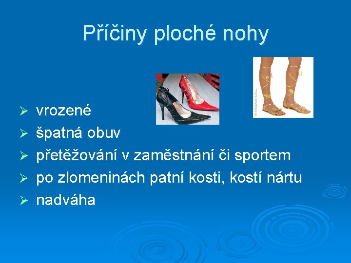 Příčiny ploché nohy Ø Ø Ø vrozené špatná obuv přetěžování v zaměstnání či sportem