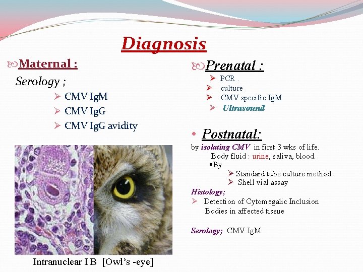 Diagnosis Maternal : Serology ; Ø CMV Ig. M Ø CMV Ig. G avidity