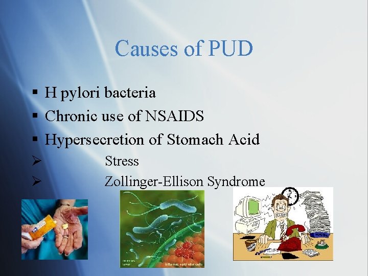 Causes of PUD H pylori bacteria Chronic use of NSAIDS Hypersecretion of Stomach Acid