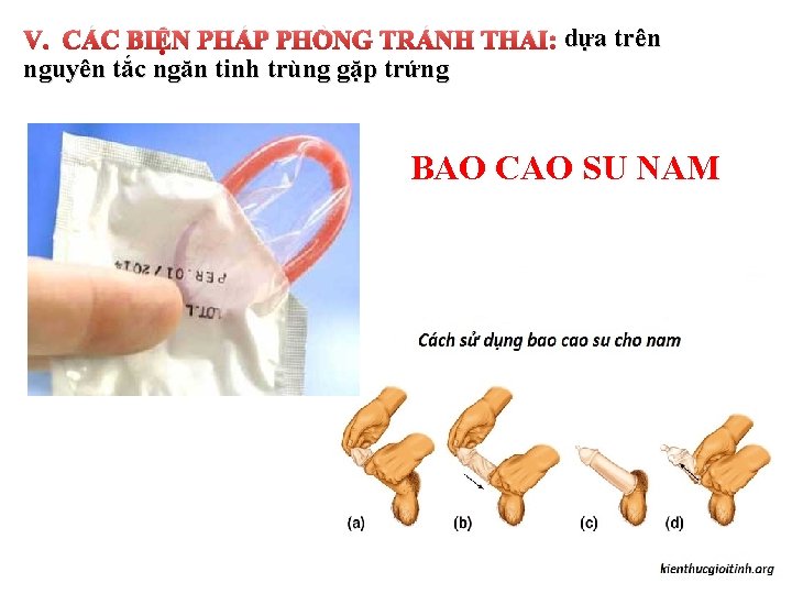 V. CÁC BIỆN PHÁP PHÒNG TRÁNH THAI: dựa trên nguyên tắc ngăn tinh trùng