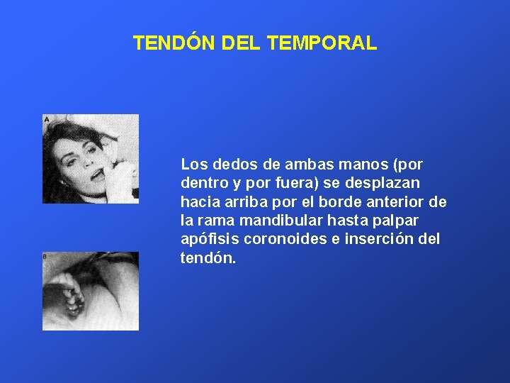 TENDÓN DEL TEMPORAL Los dedos de ambas manos (por dentro y por fuera) se