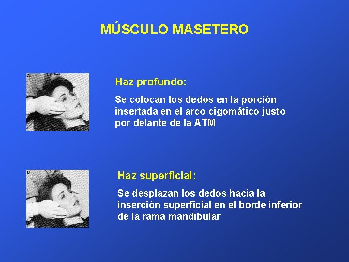 MÚSCULO MASETERO Haz profundo: Se colocan los dedos en la porción insertada en el