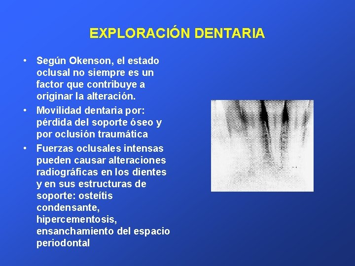 EXPLORACIÓN DENTARIA • Según Okenson, el estado oclusal no siempre es un factor que