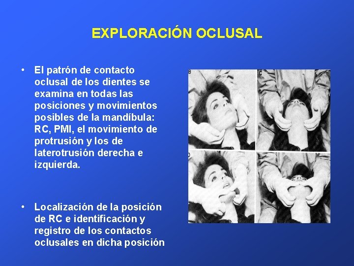 EXPLORACIÓN OCLUSAL • El patrón de contacto oclusal de los dientes se examina en