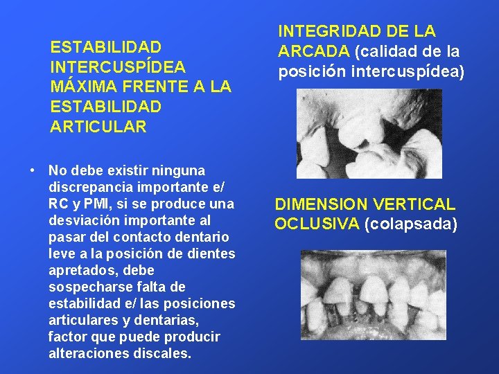 ESTABILIDAD INTERCUSPÍDEA MÁXIMA FRENTE A LA ESTABILIDAD ARTICULAR • No debe existir ninguna discrepancia