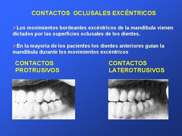 CONTACTOS OCLUSALES EXCÉNTRICOS ØLos movimientos bordeantes excéntricos de la mandíbula vienen dictados por las
