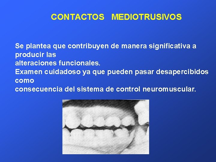 CONTACTOS MEDIOTRUSIVOS Se plantea que contribuyen de manera significativa a producir las alteraciones funcionales.
