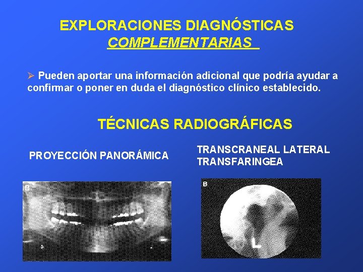 EXPLORACIONES DIAGNÓSTICAS COMPLEMENTARIAS Ø Pueden aportar una información adicional que podría ayudar a confirmar
