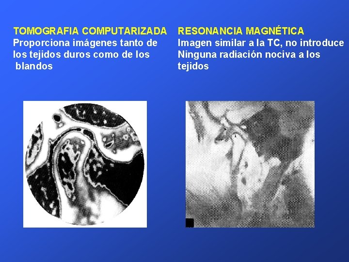 TOMOGRAFIA COMPUTARIZADA Proporciona imágenes tanto de los tejidos duros como de los blandos RESONANCIA