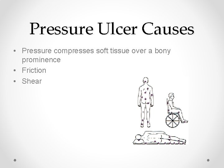 Pressure Ulcer Causes • Pressure compresses soft tissue over a bony prominence • Friction