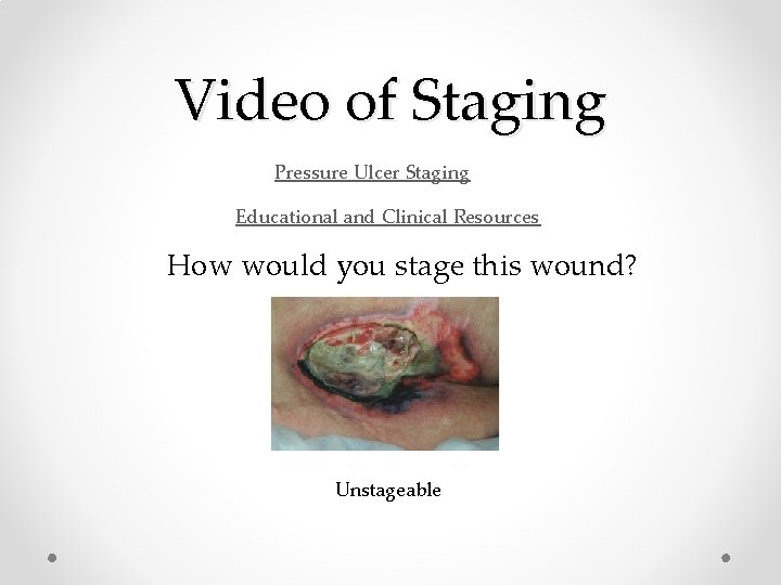 Video of Staging Pressure Ulcer Staging Educational and Clinical Resources How would you stage