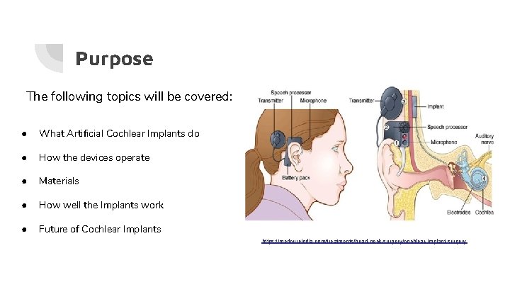 Purpose The following topics will be covered: ● What Artificial Cochlear Implants do ●