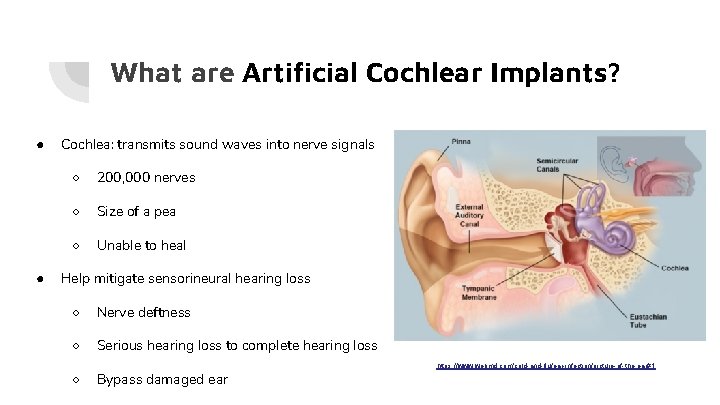 What are Artificial Cochlear Implants? ● ● Cochlea: transmits sound waves into nerve signals