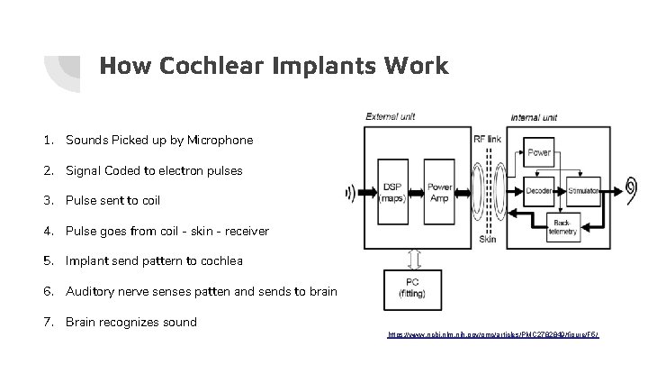 How Cochlear Implants Work 1. Sounds Picked up by Microphone 2. Signal Coded to