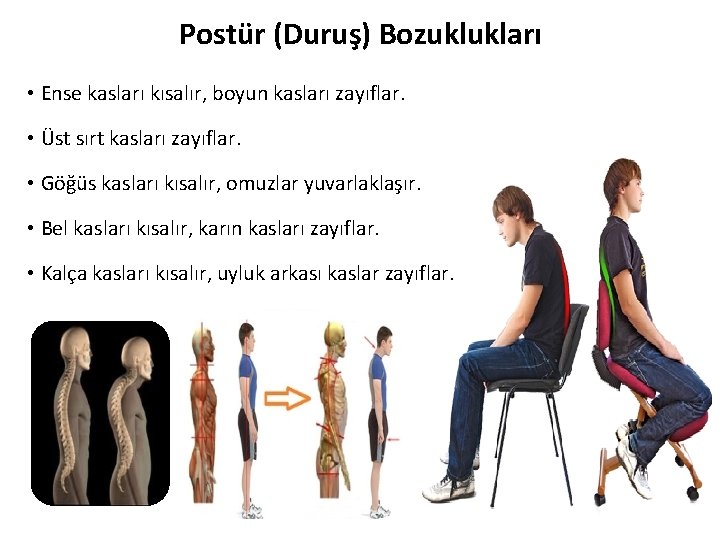 Postür (Duruş) Bozuklukları • Ense kasları kısalır, boyun kasları zayıflar. • Üst sırt kasları