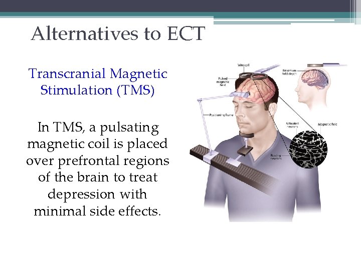 Alternatives to ECT Transcranial Magnetic Stimulation (TMS) In TMS, a pulsating magnetic coil is