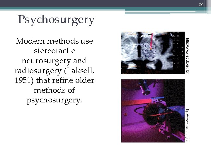 21 Psychosurgery http: //www. epub. org. br Modern methods use stereotactic neurosurgery and radiosurgery