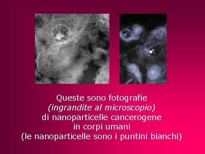Queste sono fotografie (ingrandite al microscopio) di nanoparticelle cancerogene in corpi umani (le nanoparticelle