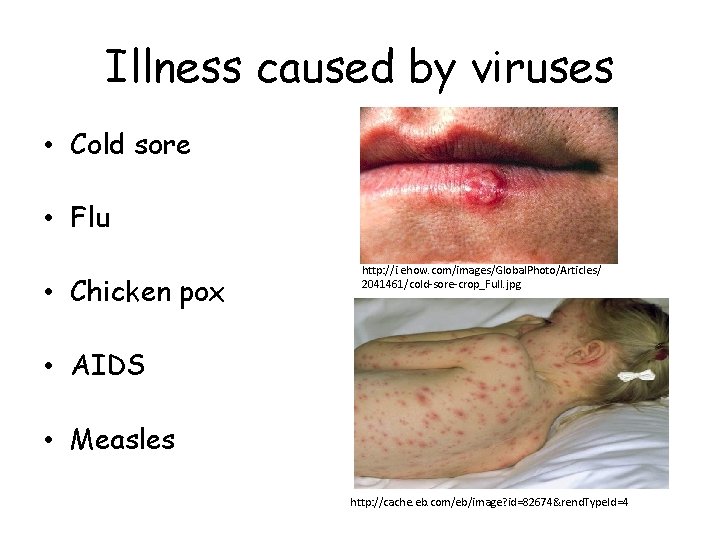 Illness caused by viruses • Cold sore • Flu • Chicken pox http: //i.